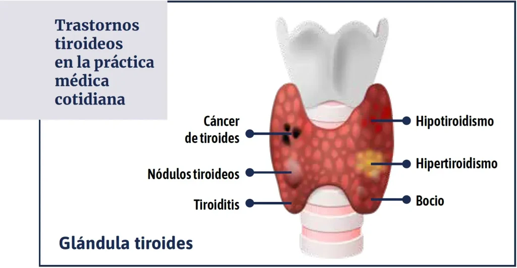 Trastornos tiroideos en la práctica médica cotidiana